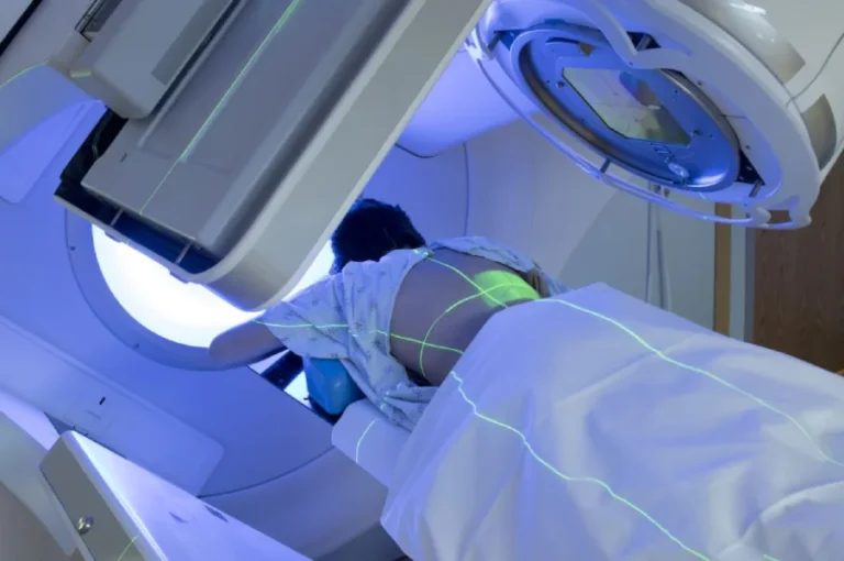 radioterapia oncologica